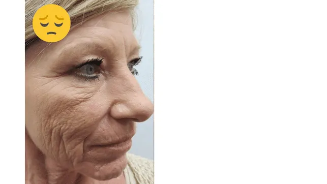Antes y después del ReviSOFT