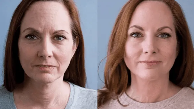Antes y después de Cris Torentino